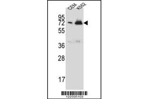 Western Blotting (WB) image for anti-Complement Factor H-Related 5 (CFHR5) antibody (ABIN2160058)