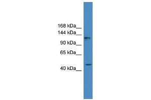 Image no. 1 for anti-Adenylate Cyclase 2 (Brain) (ADCY2) (Middle Region) antibody (ABIN928275)