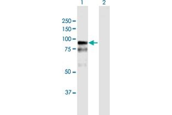 anti-Bromodomain Adjacent To Zinc Finger Domain, 2B (BAZ2B) (AA 1-643) antibody