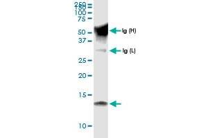 Immunoprecipitation of CCL15 transfected lysate using anti-CCL15 MaxPab rabbit polyclonal antibody and Protein A Magnetic Bead , and immunoblotted with CCL15 MaxPab rabbit polyclonal antibody (D01) .