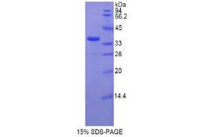 Image no. 1 for Telomerase Reverse Transcriptase (TERT) (AA 673-976) protein (His tag) (ABIN1878403)