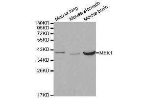 MEK1 Antikörper  (AA 1-100)