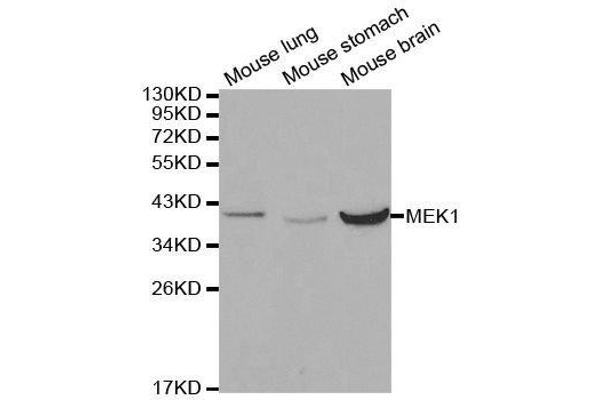 MEK1 Antikörper  (AA 1-100)