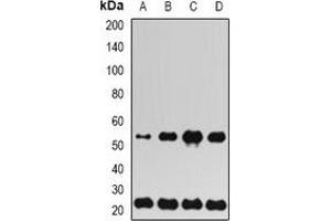 Image no. 2 for anti-Ubiquitin-Conjugating Enzyme E2H (UBE2H) antibody (ABIN3198364)