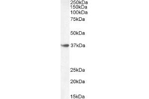 Image no. 3 for anti-Homeobox A10 (HOXA10) (Internal Region) antibody (ABIN1590026)