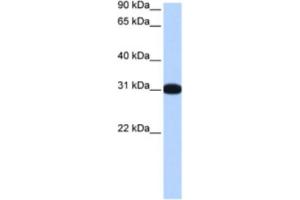 Image no. 1 for anti-Muscleblind-Like 2 (MBNL2) antibody (ABIN2463438)