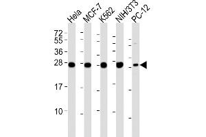 Image no. 1 for anti-Eukaryotic Translation Initiation Factor 4E Family Member 2 (EIF4E2) antibody (ABIN4910868)