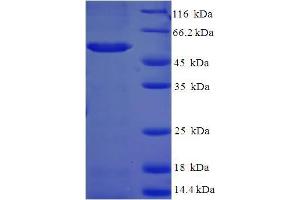 AKR1C2 Protein (AA 1-323, full length) (His-SUMO Tag)