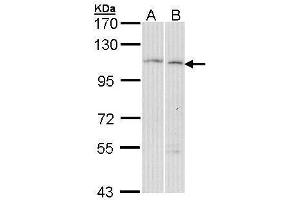 Image no. 2 for anti-Glucosidase, Alpha, Neutral AB (GANAB) (C-Term) antibody (ABIN2855321)