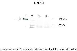 Image no. 2 for anti-Synapse Defective 1, rho GTPase, Homolog 1 (SYDE1) (N-Term) antibody (ABIN2775535)