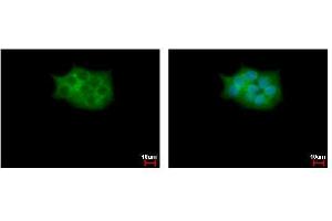Image no. 1 for anti-Src Kinase Associated Phosphoprotein 2 (SKAP2) (C-Term) antibody (ABIN2856343)