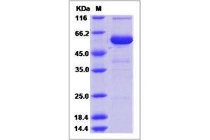 Image no. 1 for Cysteine-Rich Secretory Protein 1 (CRISP1) (AA 1-244) protein (Fc Tag) (ABIN2650836)