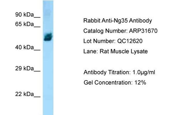ZBTB12 antibody  (Middle Region)