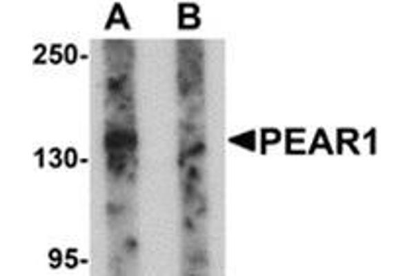 anti-Platelet Endothelial Aggregation Receptor 1 (PEAR1) (C-Term) antibody