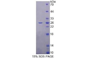 Image no. 1 for Retinol Binding Protein 3, Interstitial (RBP3) (AA 1027-1229) protein (His tag) (ABIN6238856)