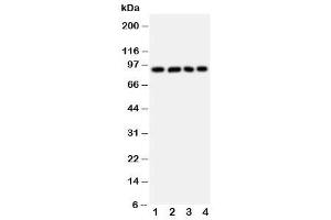 Western blot testing of IL4R antibody and Lane 1:  A431