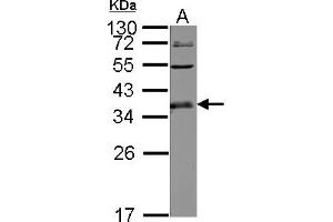 Image no. 1 for anti-UL16 Binding Protein 1 (ULBP1) (AA 1-234) antibody (ABIN1501673)
