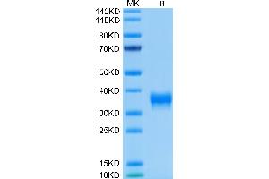 BTN1A1 Protein (His-Avi Tag)