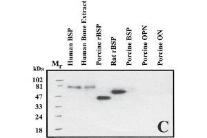Image no. 2 for anti-Bone Sialoprotein (BSP) antibody (ABIN109798)