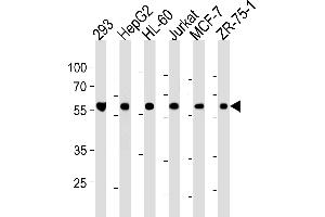 Image no. 1 for anti-Zinc Finger (CCCH Type), RNA-Binding Motif and serine/arginine Rich 2 (ZRSR2) (AA 453-482), (C-Term) antibody (ABIN1882041)