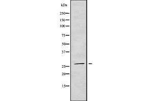 NRIP3 antibody  (C-Term)