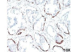 Image no. 1 for anti-Cytokeratin HMW (KRT1) antibody (ABIN3026726)