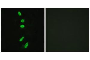 Image no. 3 for anti-Splicing Factor 1 (SF1) (Ser82) antibody (ABIN1847974)