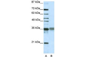 Image no. 2 for anti-T-Cell Leukemia Homeobox 2 (TLX2) (C-Term) antibody (ABIN2781001)