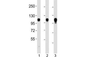 Image no. 1 for anti-Integrin, alpha 7 (ITGA7) (C-Term) antibody (ABIN3031401)