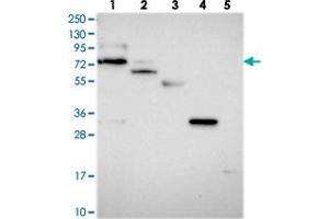 Image no. 1 for anti-rho GTPase Activating Protein 44 (ARHGAP44) antibody (ABIN5572968)