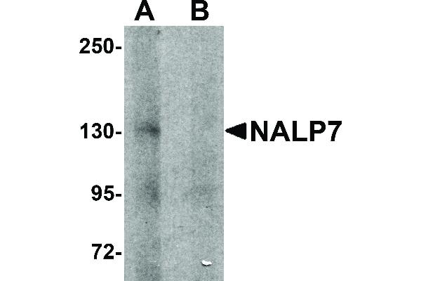 NLRP7 抗体  (N-Term)