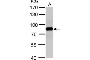 Image no. 5 for anti-Vacuolar Protein Sorting 35 (VPS35) (C-Term) antibody (ABIN2856562)