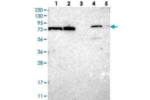 TTC14 anticorps