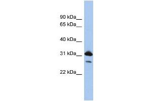 Image no. 2 for anti-RAP1B, Member of RAS Oncogene Family (RAP1B) (N-Term) antibody (ABIN2786568)