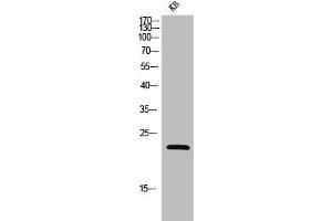 NCR3 antibody  (Internal Region)