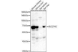 Western blot analysis of extracts of various cell lines, using SLC27 antibody (ABIN3021377, ABIN3021378, ABIN1513532 and ABIN6214970) at 1:567 dilution.