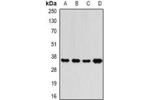 Image no. 2 for anti-Replication Factor C (Activator 1) 5, 36.5kDa (RFC5) (full length) antibody (ABIN6006034)