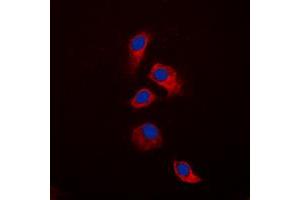 Image no. 1 for anti-Tumor Necrosis Factor Receptor Superfamily, Member 11b (TNFRSF11B) (N-Term) antibody (ABIN2707669)