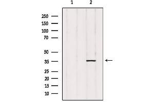 Image no. 2 for anti-Prostaglandin Reductase 2 (PTGR2) antibody (ABIN6257815)