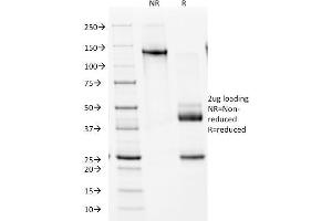 Image no. 1 for anti-NK2 Homeobox 2 (Nkx2-2) (AA 1-119) antibody (ABIN6940202)