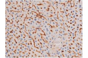 Image no. 2 for anti-Insulin Receptor Substrate 1 (IRS1) (pSer636) antibody (ABIN6255436)