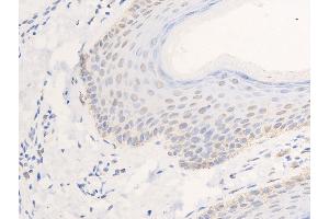Image no. 2 for anti-Epidermal Growth Factor Receptor (EGFR) (pSer1026) antibody (ABIN6254923)
