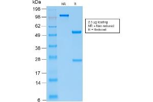 Image no. 1 for anti-Parathyroid Hormone (PTH) (AA 32-115) antibody (ABIN6940428)