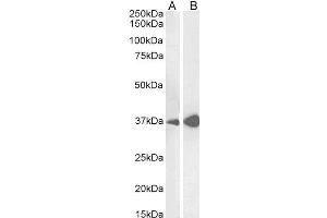 Image no. 1 for anti-Arginase, Liver (ARG1) (C-Term) antibody (ABIN190828)