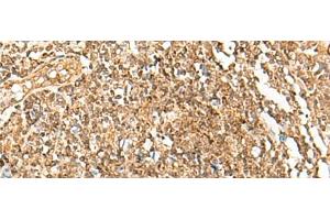 Immunohistochemistry of paraffin-embedded Human tonsil tissue using POLH Polyclonal Antibody at dilution of 1:45(x200)