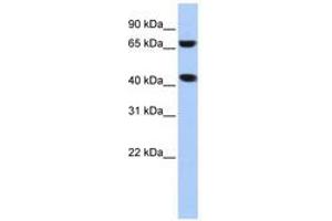 Image no. 1 for anti-ELAC1 (ELAC1) (N-Term) antibody (ABIN6740727)