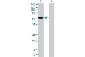 Image no. 2 for anti-Casein Kinase 1, gamma 2 (CSNK1G2) (AA 1-415) antibody (ABIN514701)