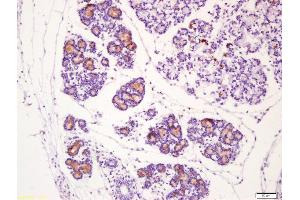 Image no. 3 for anti-Osteocalcin (BGLAP) (AA 21-100) antibody (ABIN1385851)