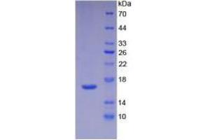Image no. 3 for Interleukin 16 (IL16) (AA 1203-1332) (Active) protein (His tag) (ABIN6239762)