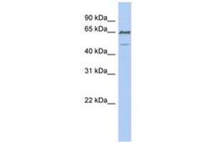 Image no. 1 for anti-DiGeorge Syndrome Chromosome Region-2 (DGS2) (N-Term) antibody (ABIN6743429)